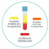 PRP - Extracao do prp