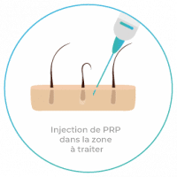 PRP_4-200x200